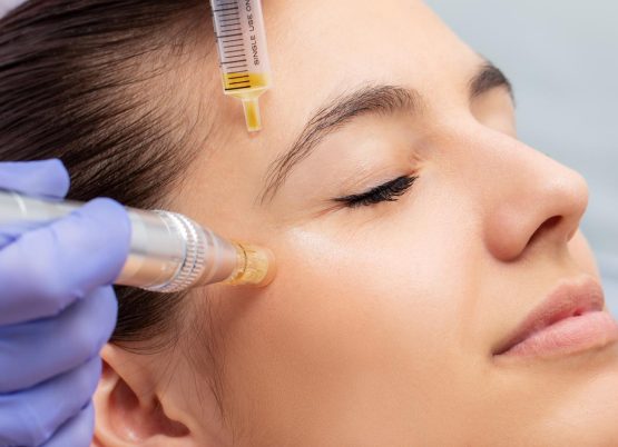 Macro close up of therapist injecting enzymes and with derma pen around woman's eyes.