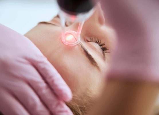 Caucasian female getting a laser skin treatment
