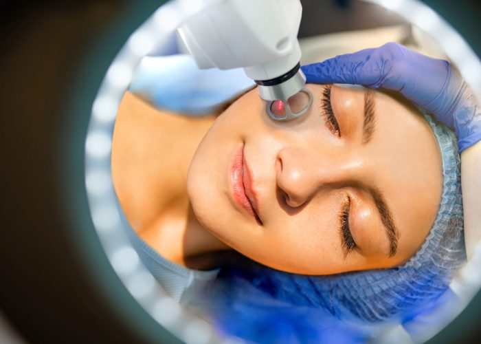 Face Having A Laser Skin Treatment, A Resurfacing Technique For Wrinkles
